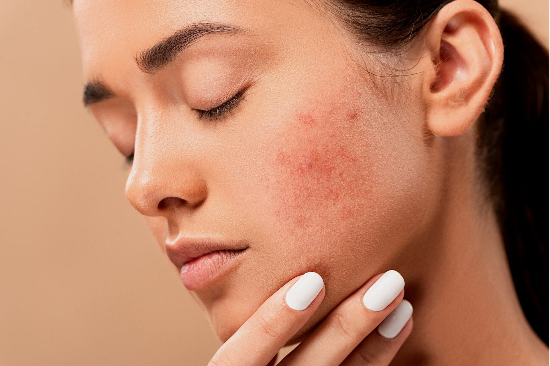 Comment se débarrasser des boutons de règles ?
